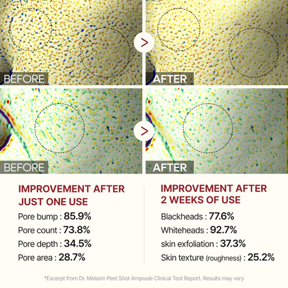 PEEL SHOT CARE BUNDLE SET